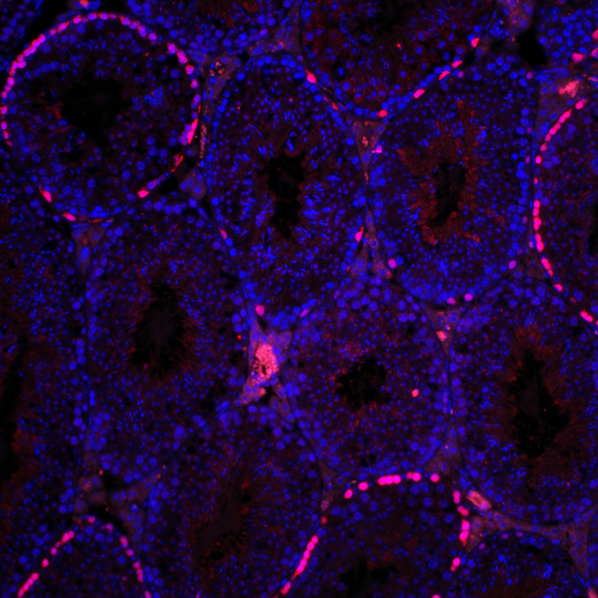 SIRT1 overexpression in spermatogonial stem cells to prom... | ResearchHub